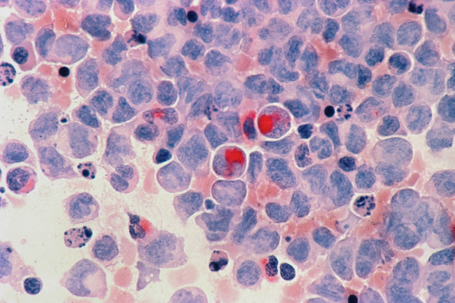 Toxoplasma gondii