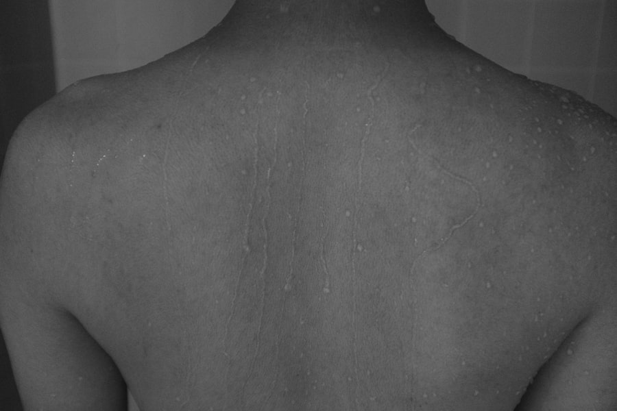 Photo pain tolerance