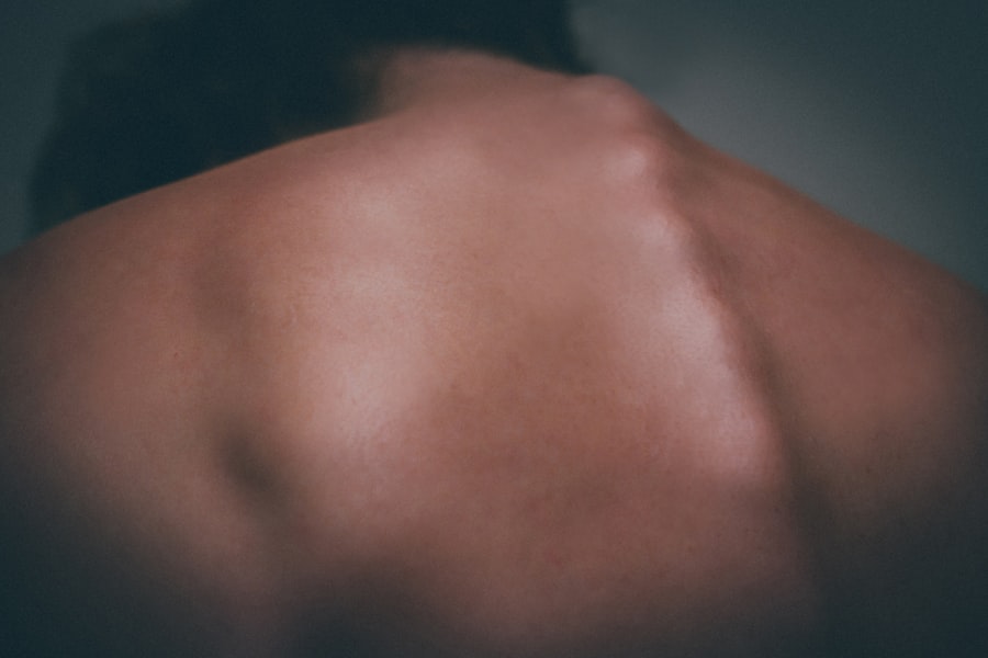 Photo bypassing the pain barrier