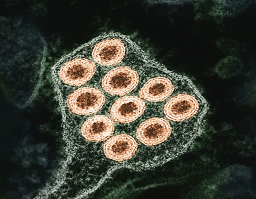 Photo marine viruses