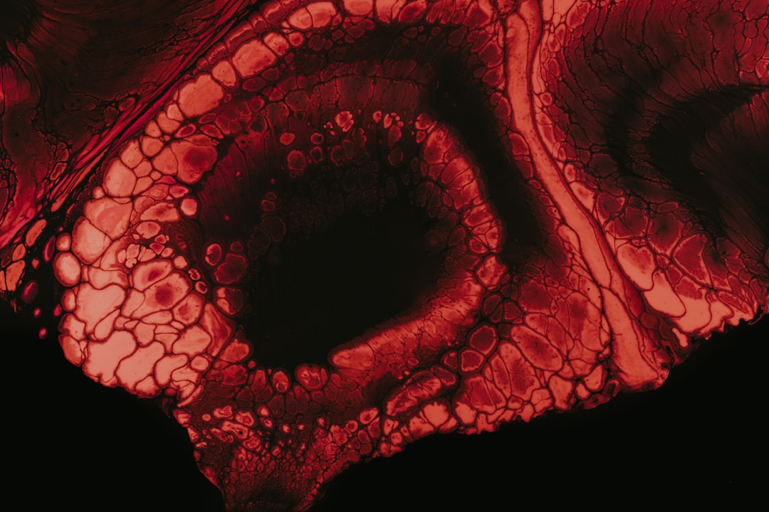 Photo T gondii infection