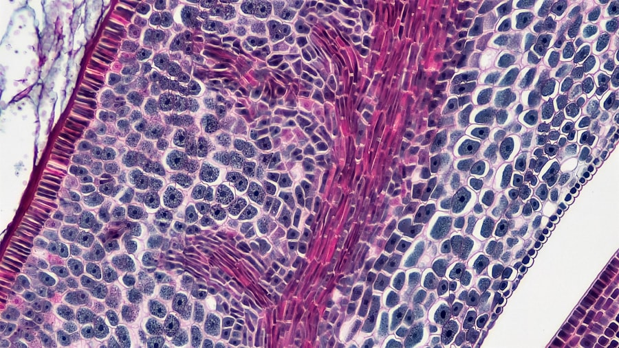 Photo Toxoplasma gondii