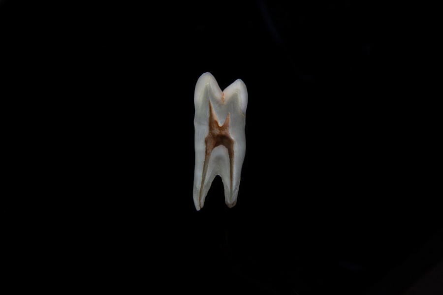 Photo piltdown man teeth