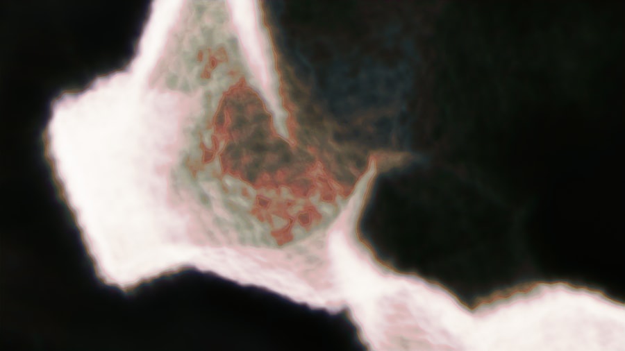 Photo solvents, neurodegenerative, risk