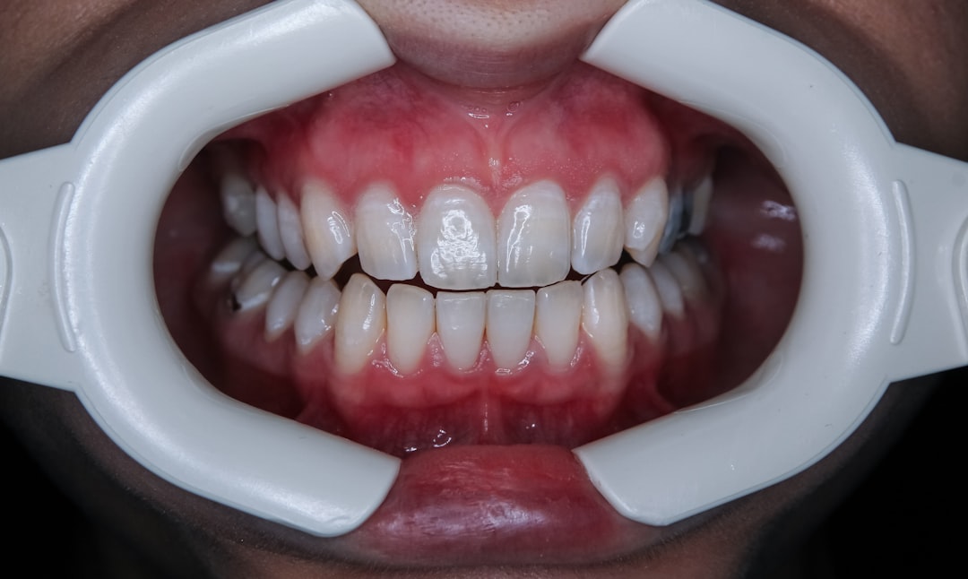 Photo periodontitis